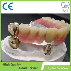 Dental Implant Zirconia Crown and Bridge OEM Bruxzir Solid Stable Zirconia Bridge From China Dental Lab