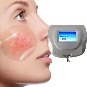 Newest 30MHz High Frequency Varicose Vein Vascular Removal Rbs Laser Machine