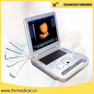 Low Price Laptop 3D Ultrasound Machine Portable Color Doppler Ultrasound Scanner Price