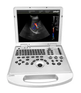 Factory Price Basic Color Ultrasound Full Application Ultrasound Diagnostic System