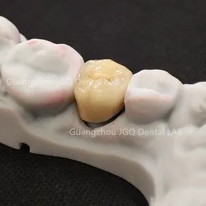 Great Fit Unbreakable Metal Ceramic Pfm Crowns and Bridges Free Samples Good Price