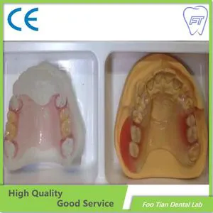 Removable Denture Cast Partial Framework Dental Customized