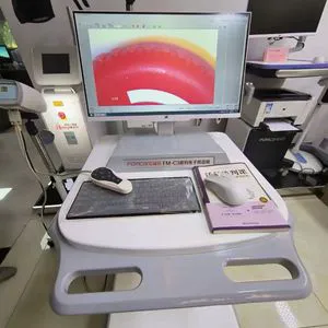 Digital Colposcope with Facordigital Electronic Colposcope Colposcopy Machine for Gynaecology