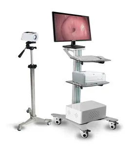 My-F003 Gynecology and Obstetrics Equipment Portable Electronic Digital Colposcope
