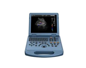 Dw-L50 Laptop Style Color Doppler Ultrasound Machine 4D/5D Ob Specialized