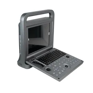 High Quality Ultrasound Scan Machine Medical Ultrasound Scanner Color Doppler Ultrasound