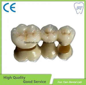 Implant Bridge Dental Lab Zirconia Crown and Bridge Made From China