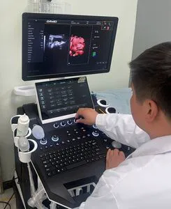 3D 4D 5D Full Digital Trolley Color Doppler Ultrasound Scanner Trolley Ultrasound