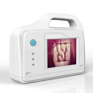 Infrared Portable Vein Locator Vein Detector