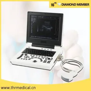 Medical Equipment Portable Laptop Full Digital B/W Ultrasound Scanner Price