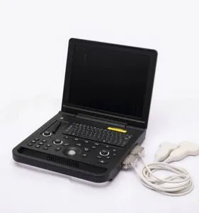 High Resolution Portable Ultrasound Scanner with Lithium Battery Technology