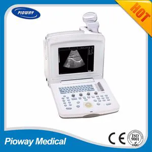 Hospital Equipment Portable Ultrasound Machine / Ultrasound Scanner (PW-180)