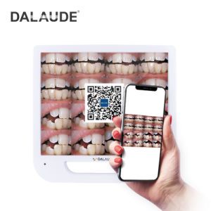 15 MP High Resolution with 17inch Monitor Dental Digital Camera Viewer Intraoral Camera Oral Camera with Multimedia and Wi-Fi Camera USB Storage
