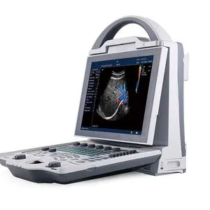 Human Use Medical Diagnostic Imaging Equipment Portable 2D Ultrasound Scan