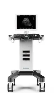 Trolley Ultrasound Black and White Hospital Equipment