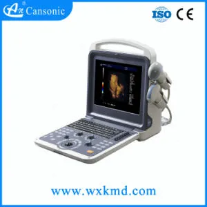 Color Doppler Ultrasound Scanner Medical Equipment