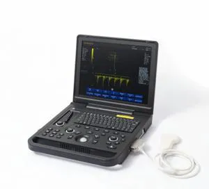 Compact Medical Portable Ultrasound Scanner with Advanced Imaging Technology
