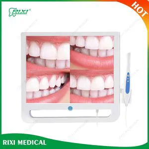Aluminum ISO Approved Rixi Dental Chair Unit Compact Oral High-Resolution Camera with Factory Price