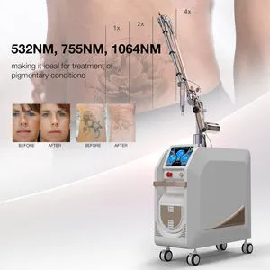 Hot Sale ND YAG Laser Tattoo Removal Carbon Laser Peel Picosecond Laser Machine