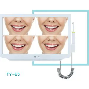 High Definition Dental Digital Camera Viewer Intraoral Camera Oral Camera with Multimedia and Wi-Fi Camera