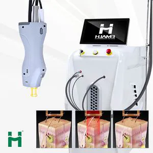 755nm 1064nm Long Pulse Laser Alexandrite Full Body Long Pulse Laser Alex Hair Removal Painless Hair Removal Laser