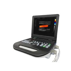 Medical Portable Color Digital Ultrasound Ultrasonic Scanner Diagnosis System for Human Vet Hospital Clinic