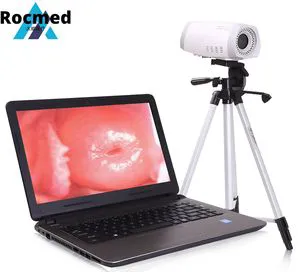 Digital Full HD Electronic Video Colposcope, Medical Instrument Gynecology Examination Digital Laptop Colposcopy Portable Laptop Vaginal Colposcope Video