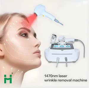 1470nm Laser Machine Portable Facial Rejuvenation Wrinkle Removal for Sale