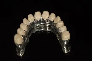 Full Arch Implant Bridges Made in China Dental Lab Dental Implant
