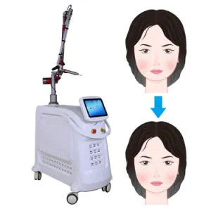 Tga Approved Picosecond Alexandrite Laser Q Switched ND: YAG for Salon/SPA/Clinic
