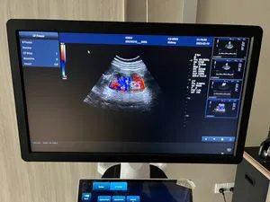 Dw-T50 Dual-Screen Cart-Based Color Doppler Ultrasound Diagnostic System with 4D Imaging