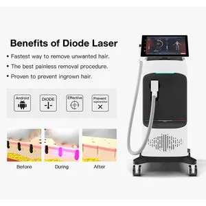 Innovative Hair Removal Machine with 15.6-Inch Display Technology
