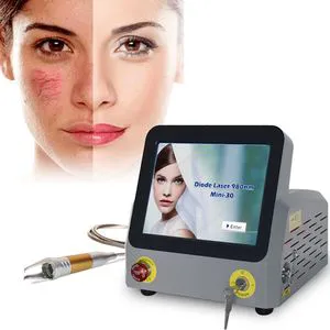 60W 980nm Diode Laser Vascular Removal Machine Spider Vein Removal 2022