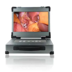 OEM Portable HD Hysteroscopy Endoscopy Camera for Surgery