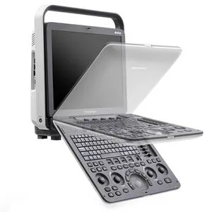 Sonoscape S8 Exp Medical Full Digital Color Doppler Portable Manufacturer Ultrasound Machine