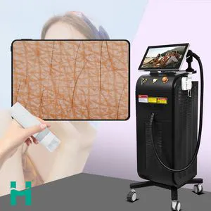 755 808 1064 Depilacion Hair Removal Laser System 808 Diode Laser Permanent Hair Removal Machine