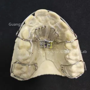 Personalized Customization Orthodontic Appliances Hawley Retainer for Dental Orthodontic Teeth Model for Oral Health