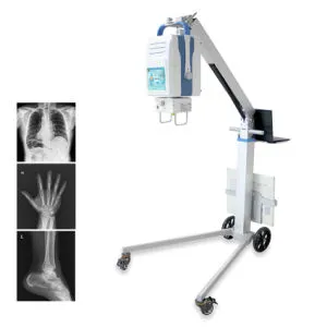 My-D049r China X-ray Machine, Digital Portable Mobile Medical X-ray Equipment
