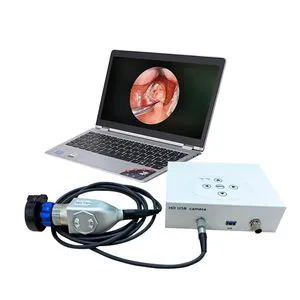 in-HD7020 Ent Digital Video Portable Cystoscope Flexible Endoscope Endoscopy Machine Medical Veterinary USB Laryngoscope Bronchoscope