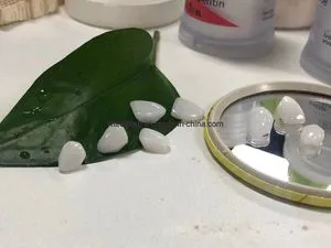 Full Dental Veneers and Laminate Veneers