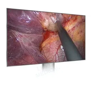 High Quality 24 Inches Table Model Surgical Equipment for Camera System