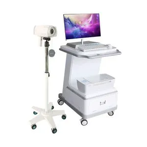 Medical Digital Electronic Video Colposcope Electronic Cervical Video Camera Colposcope Equipment for Gynecology