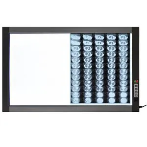 Medical LED Xray Viewing Box-LED X Ray Medical Viewing Box