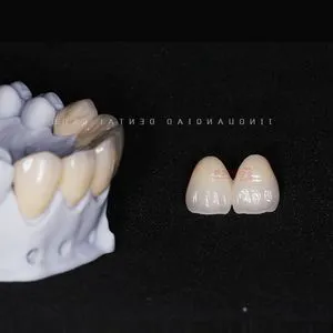 China-Made Fixed Dentures Zirconia Crown and Bridge Optimal Performance and Cost Savings