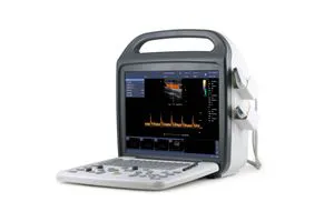 2D Portable Color Doppler Ultrasound Scanner Machine