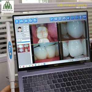 Dentistry Device Medical Zoom High Quality Dental USB Intraoral Cameras for Window System