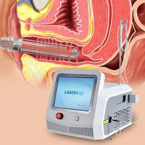 Gynecological Medical Machine Laser Therapy Vaginal Laser Machine