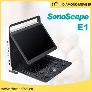 Sonoscape E1 Hospital Portable Black & White Ultrasound System Ultrasound Machine