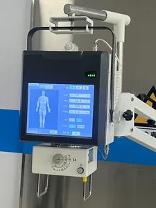New Standard for Portable X-ray Radiography Machines Medical Imaging Equipment