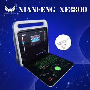 4D Portable Xf3800 Color Doppler Diagnostic Ultrasound Scanner